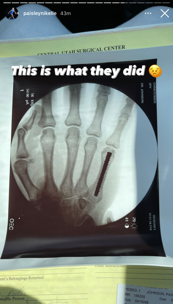 Paisley Hading X-Ray